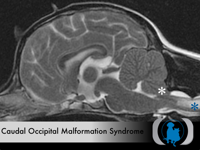 Caudal Occipital Malformation Syndrome