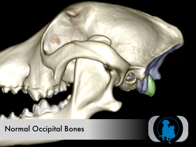 Normal occipital bones
