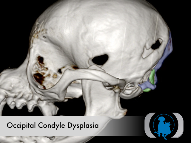 Occipital dysplasia - attenuated condyles