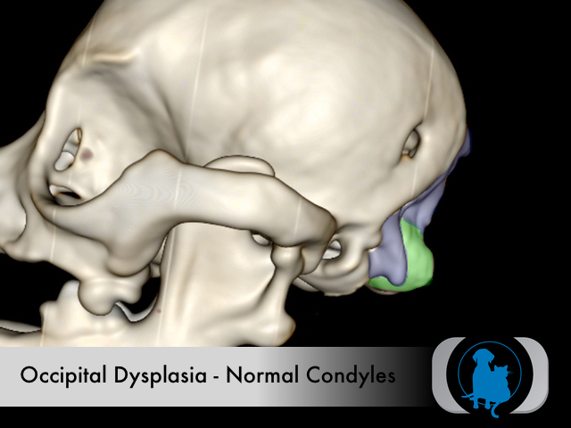Occipital dysplasia - normal condyles